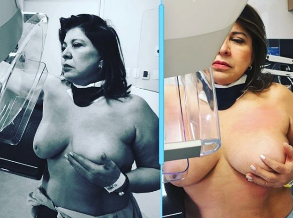 Roberta Miranda posta foto com seios de fora em consultório