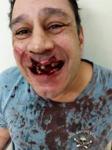 WhatsApp Image 2021-07-12 at 20.23.38 (1) A imagem mostra um homem com a boca ensanguentada