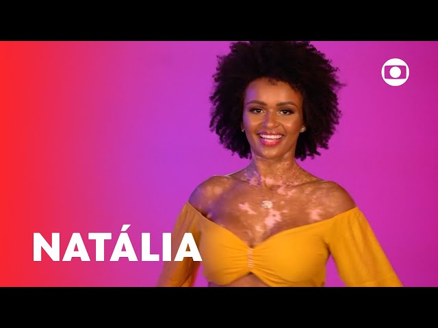 A importância da presença de Natália, e seu vitiligo, no BBB 22