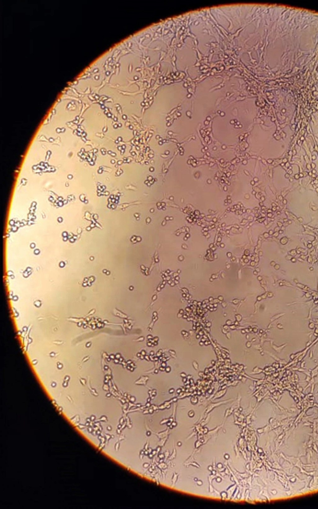 Segundo óbito por varíola dos macacos é confirmado no Rio
