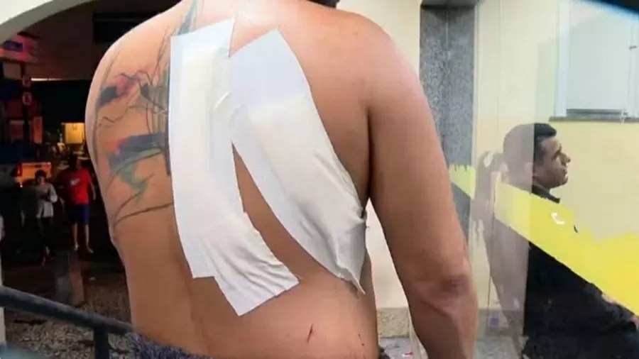 Dois foliões são esfaqueados e 70 armas brancas são apreendidas em blocos