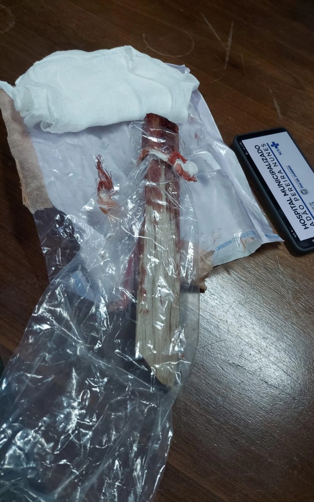 Carpinteiro atingindo por estaca vai passar por reconstrução de crânio