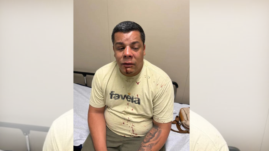 PT pede cassação de registro de candidatura de Rodrigo Amorim após agressão