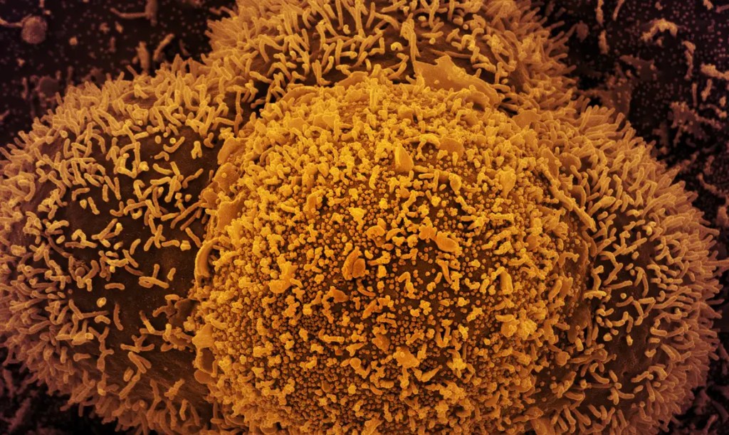 Covid-19: nova variante do vírus é identificada em pacientes cariocas