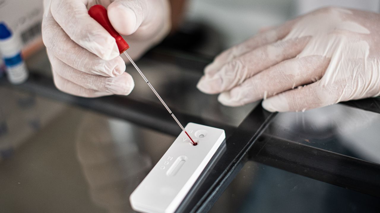 Casos de HIV aumentam no Rio; entenda os motivos