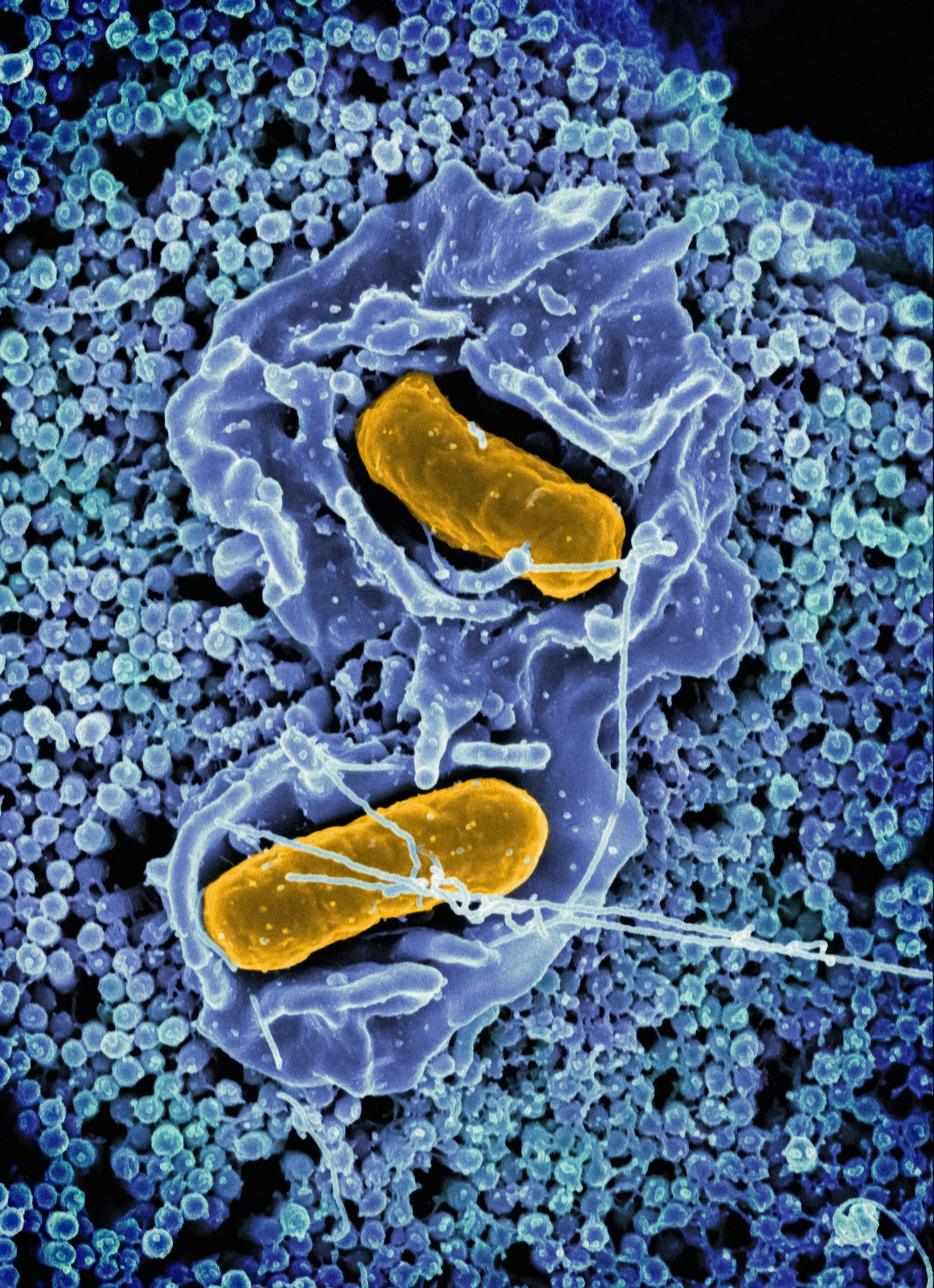 Casos de HIV e tuberculose seguem altos e preocupam saúde no Rio